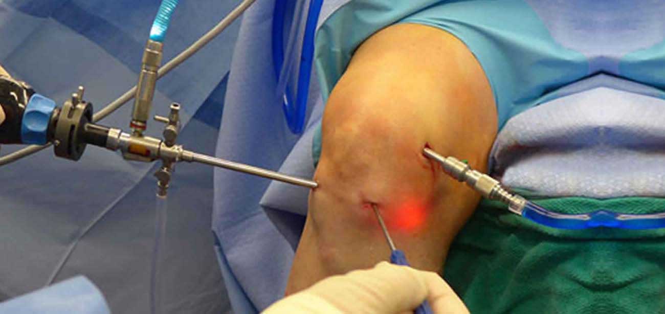 doctor performing arthroscopic surgery