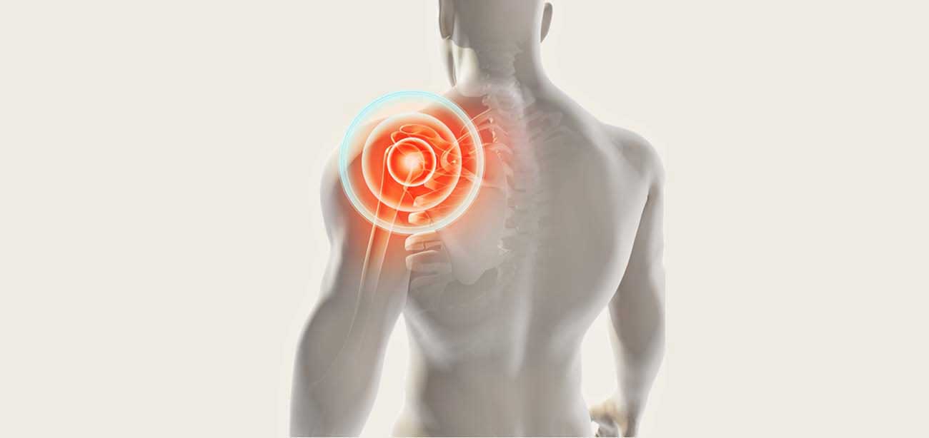 shoulder replacement surgery to treat shoulder pain
